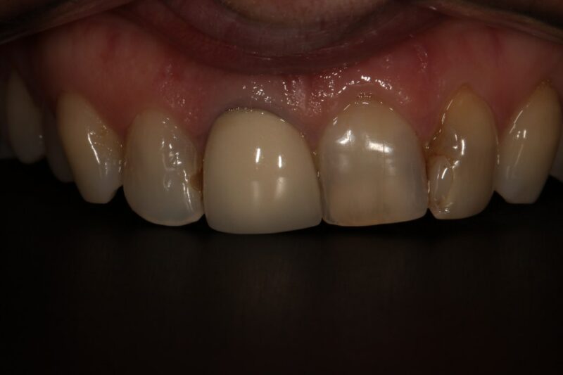 Before - Cheadle Hulme Dental