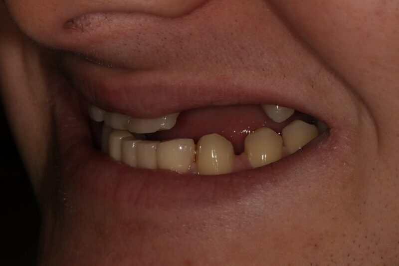 Before - Cheadle Hulme Dental