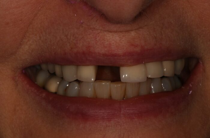 Before - Cheadle Hulme Dental