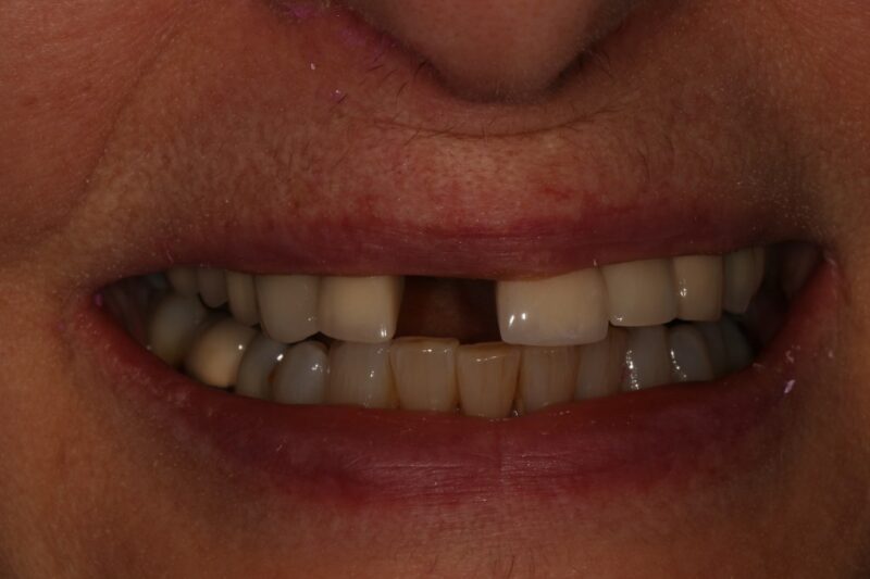 Before - Cheadle Hulme Dental