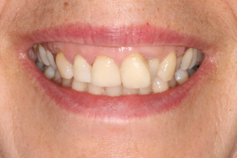 Before - Cheadle Hulme Dental