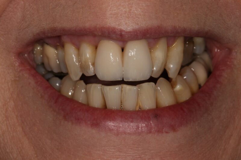 Before - Cheadle Hulme Dental