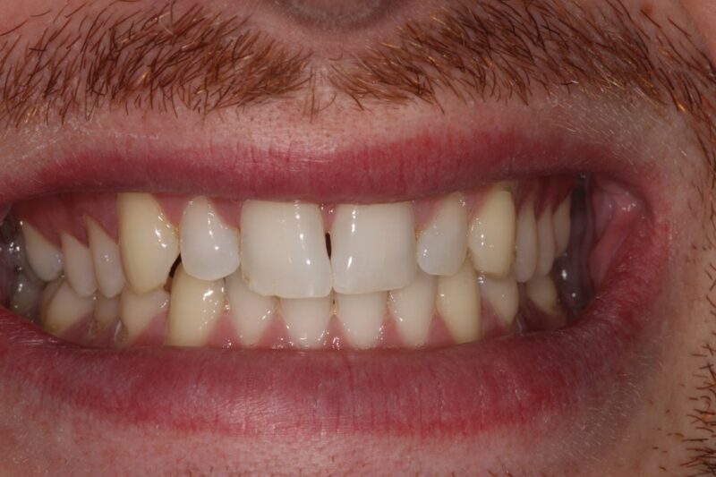 Before - Cheadle Hulme Dental