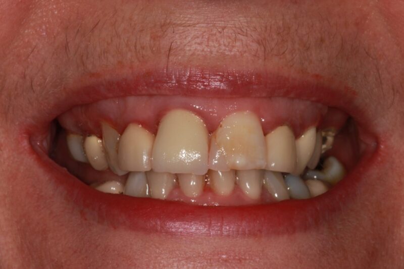 Before - Cheadle Hulme Dental