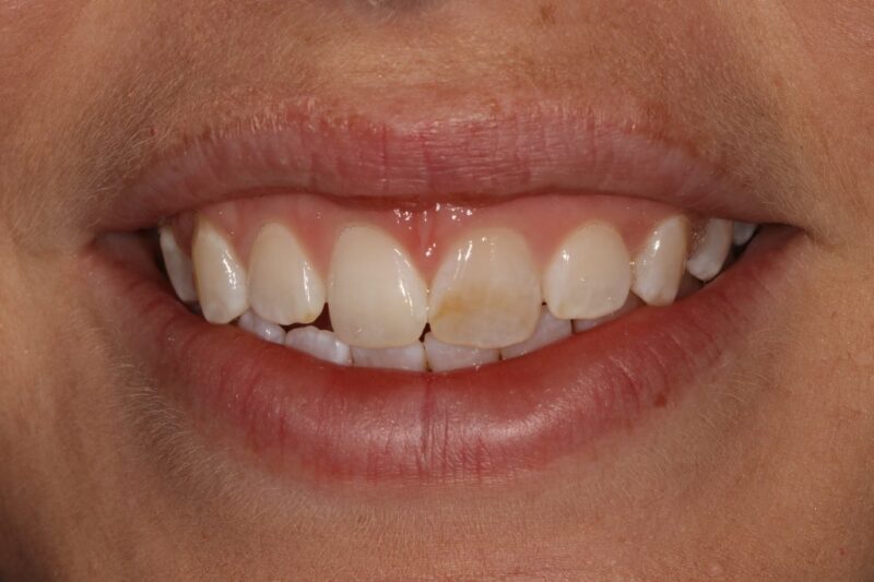 Before - Cheadle Hulme Dental