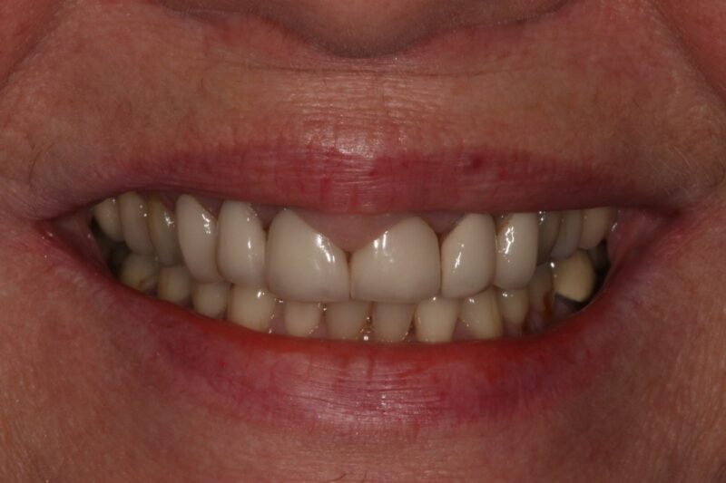 Before - Cheadle Hulme Dental