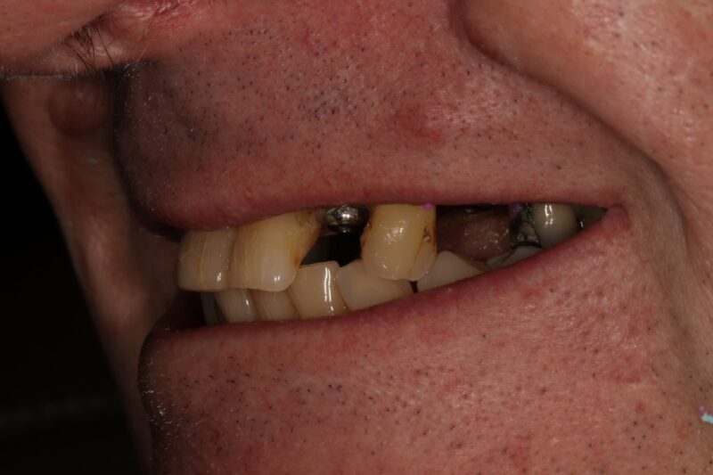 Before - Cheadle Hulme Dental