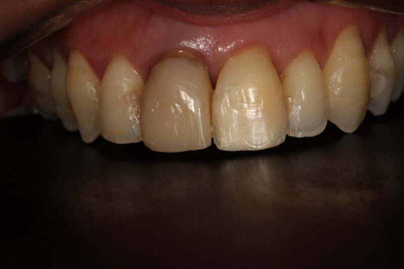 Before - Cheadle Hulme Dental