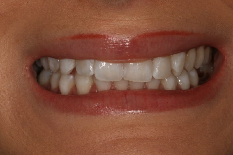 Before - Cheadle Hulme Dental