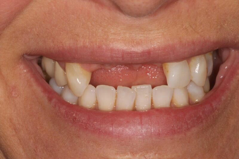 Before - Cheadle Hulme Dental