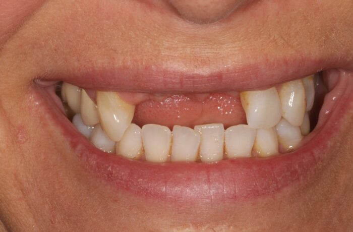 Before - Cheadle Hulme Dental