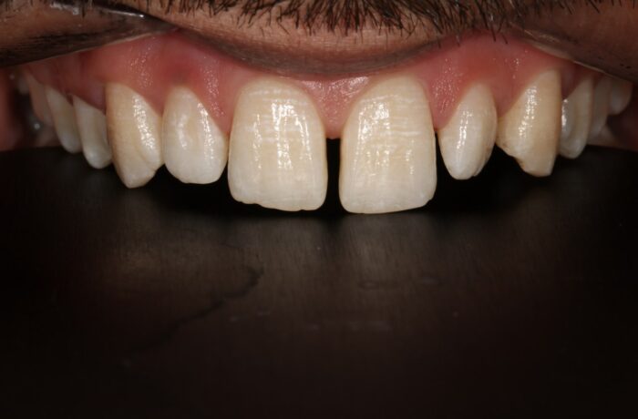 Before - Cheadle Hulme Dental