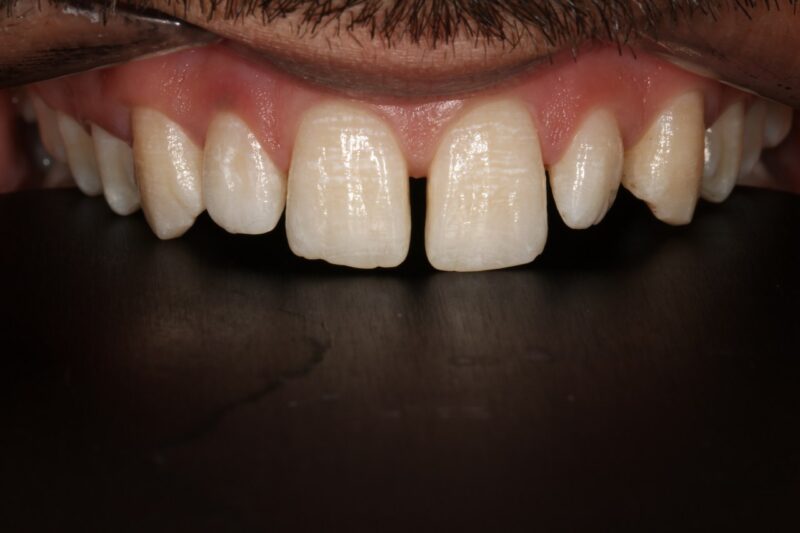 Before - Cheadle Hulme Dental