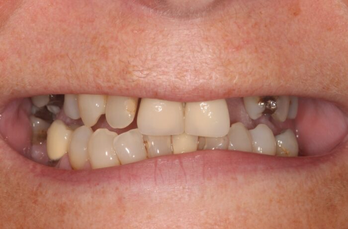 Before - Cheadle Hulme Dental