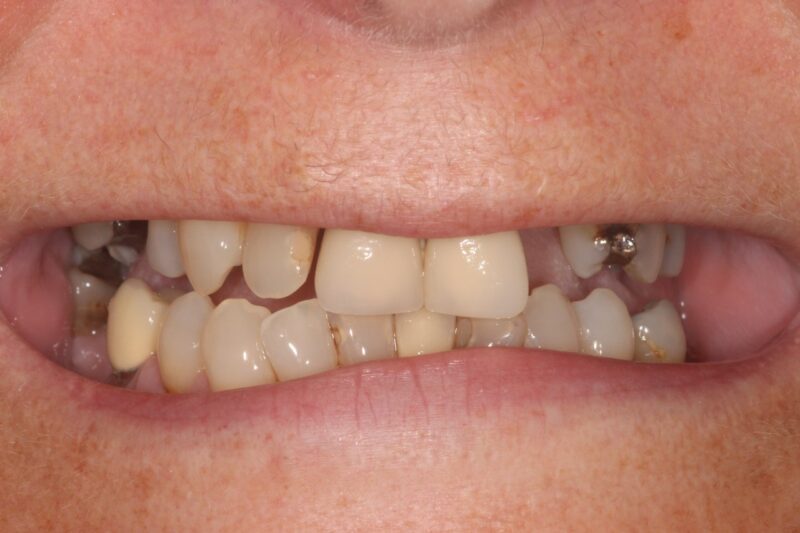 Before - Cheadle Hulme Dental