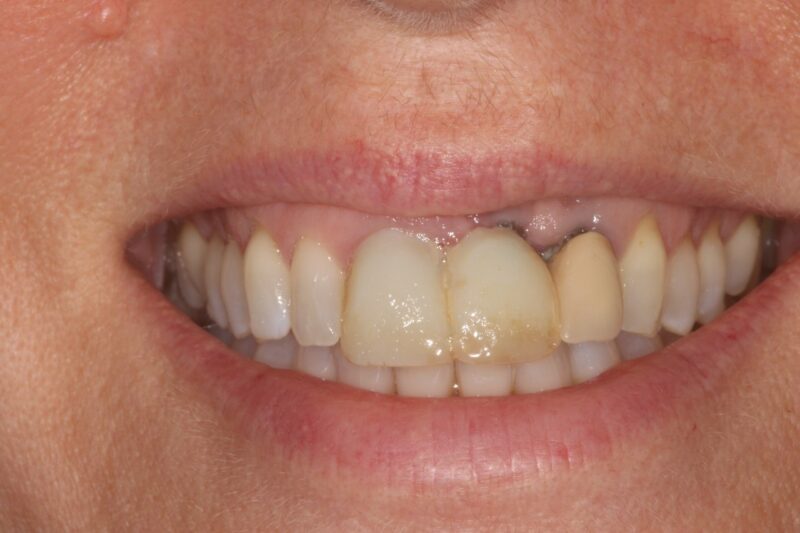 Before - Cheadle Hulme Dental