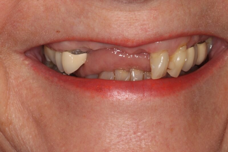 Before - Cheadle Hulme Dental