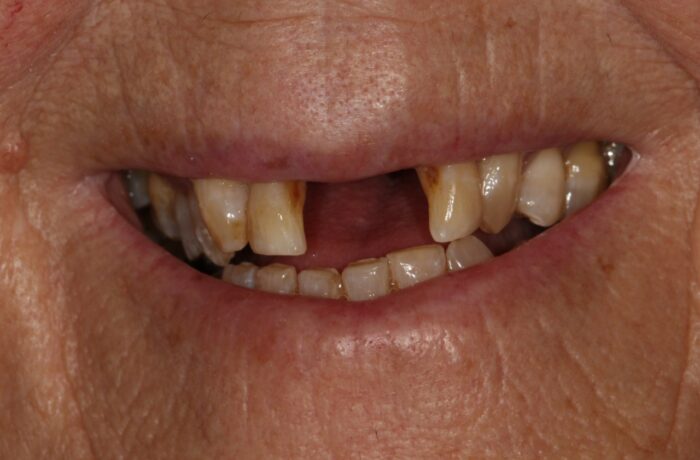 Before - Cheadle Hulme Dental