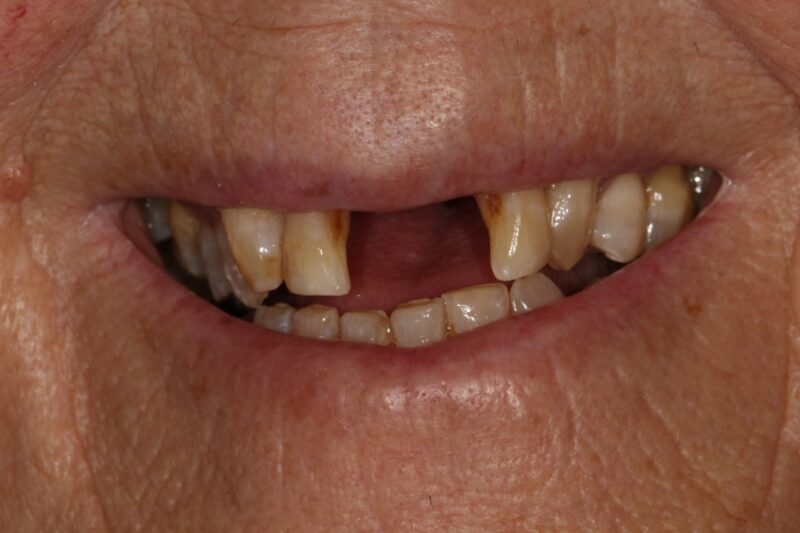 Before - Cheadle Hulme Dental