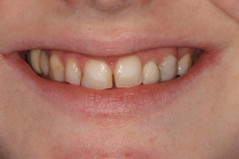 Before - Cheadle Hulme Dental