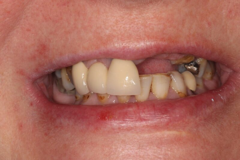 Before - Cheadle Hulme Dental