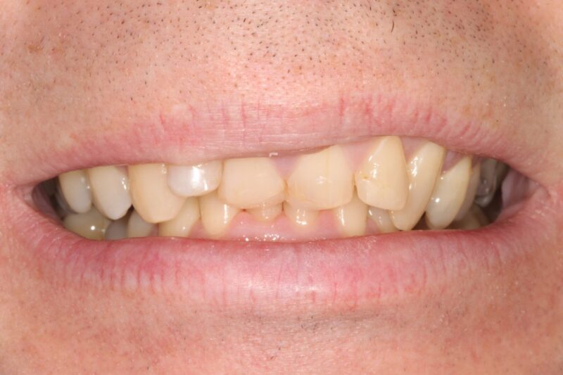 Before - Cheadle Hulme Dental