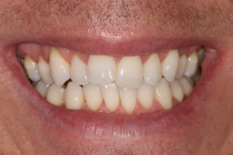 Before - Cheadle Hulme Dental