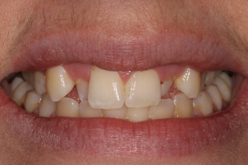 Before - Cheadle Hulme Dental