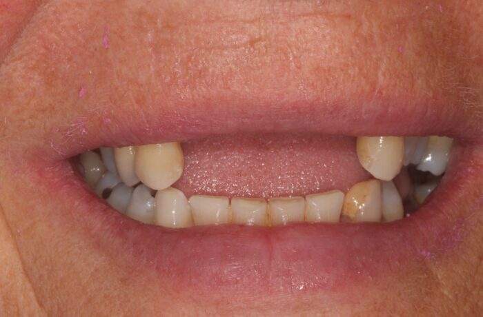 Before - Cheadle Hulme Dental