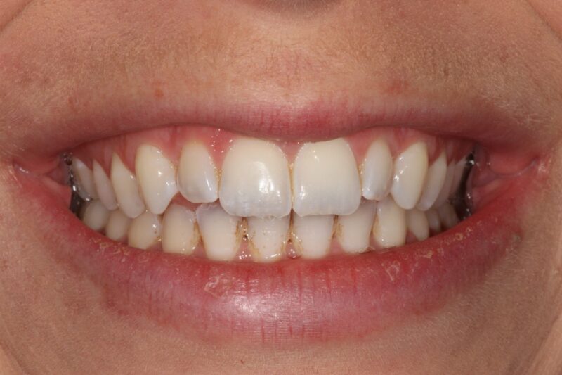 Before - Cheadle Hulme Dental