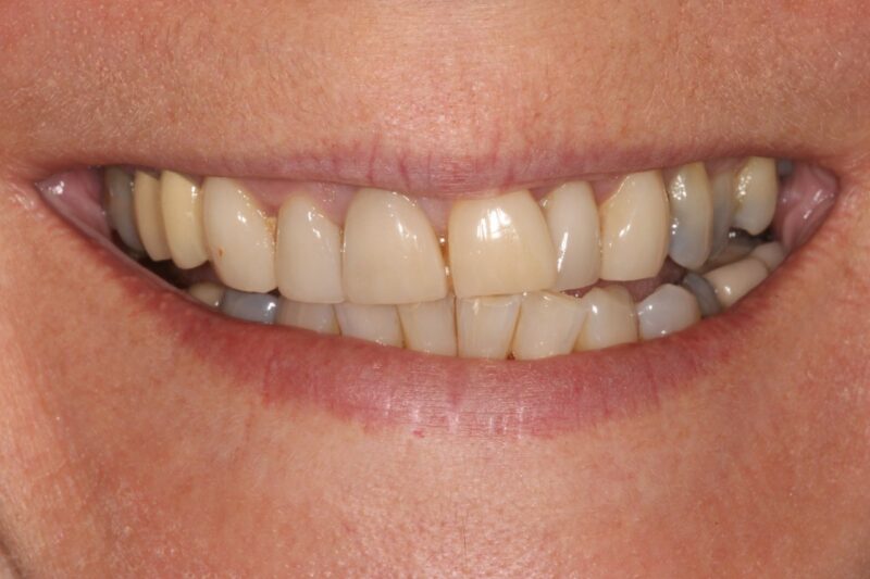 Before - Cheadle Hulme Dental