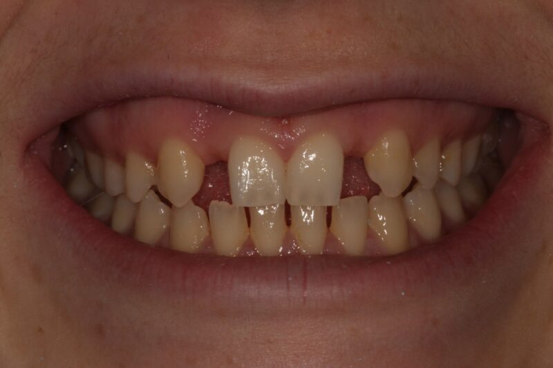 Before - Cheadle Hulme Dental