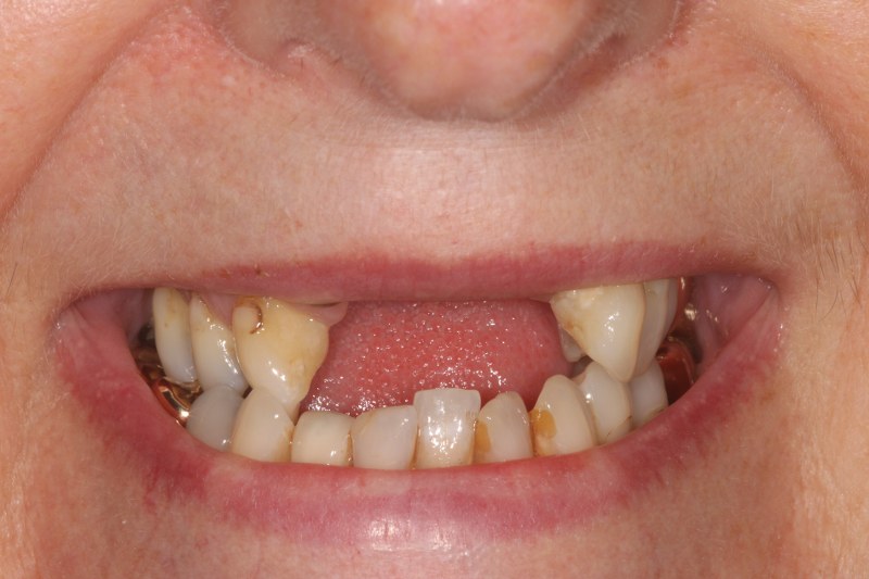 Before - Cheadle Hulme Dental