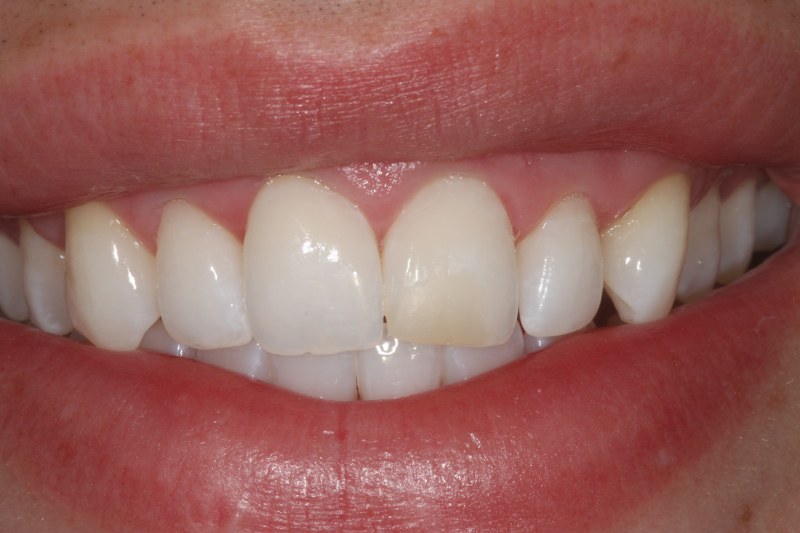 Before - Cheadle Hulme Dental