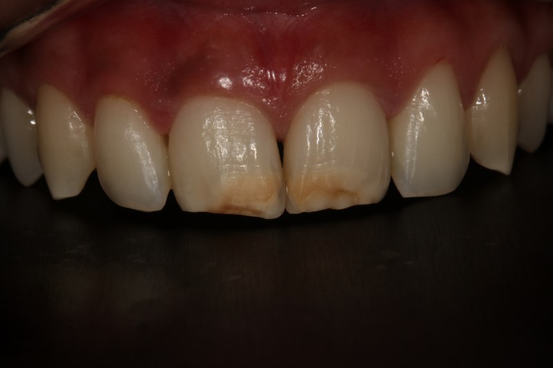 Before - Cheadle Hulme Dental