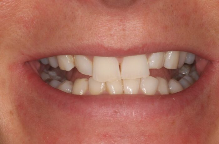 Before - Cheadle Hulme Dental