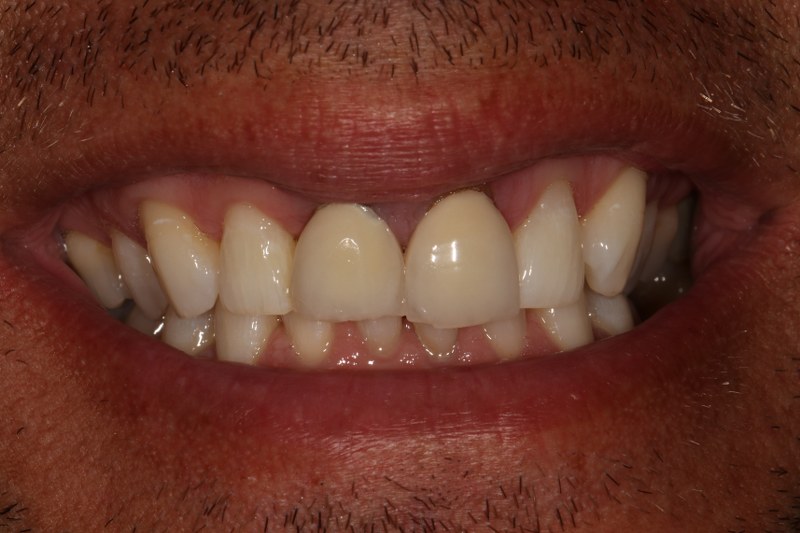 Before - Cheadle Hulme Dental