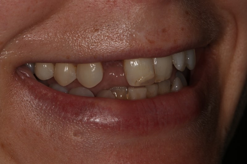 Before - Cheadle Hulme Dental