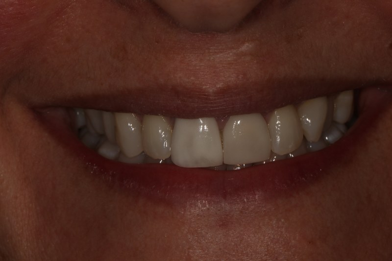 Before - Cheadle Hulme Dental