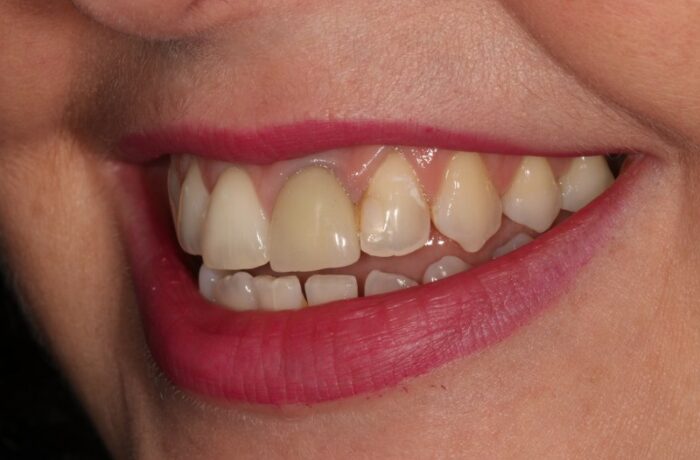 Before - Cheadle Hulme Dental
