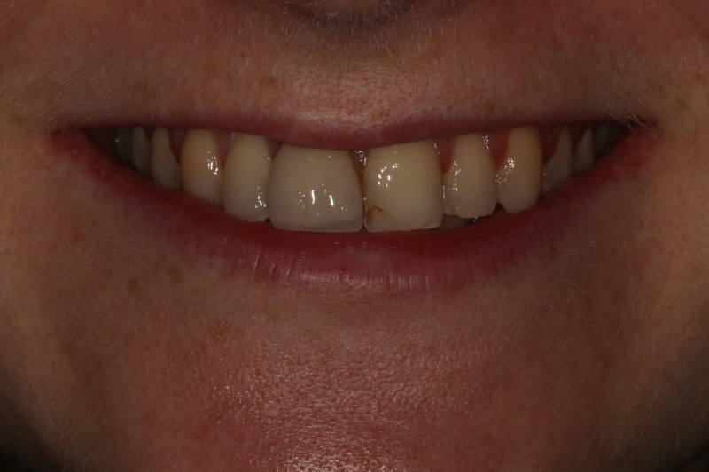 Before - Cheadle Hulme Dental