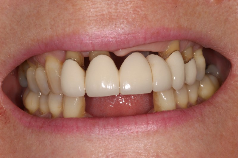 Before - Cheadle Hulme Dental