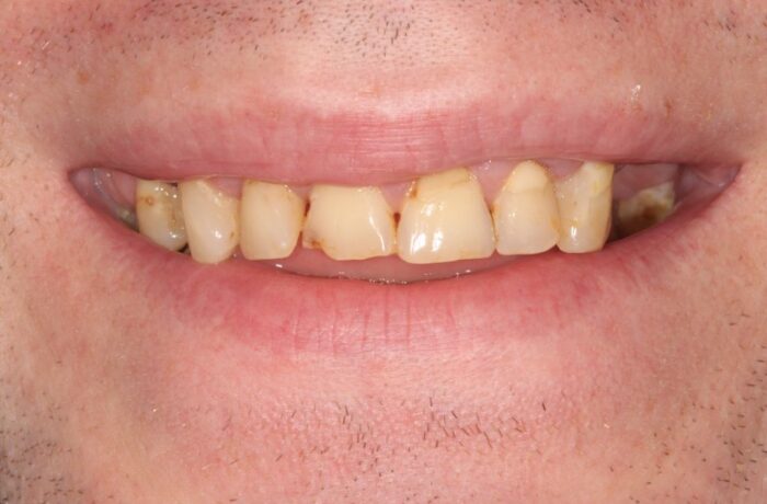 Before - Cheadle Hulme Dental