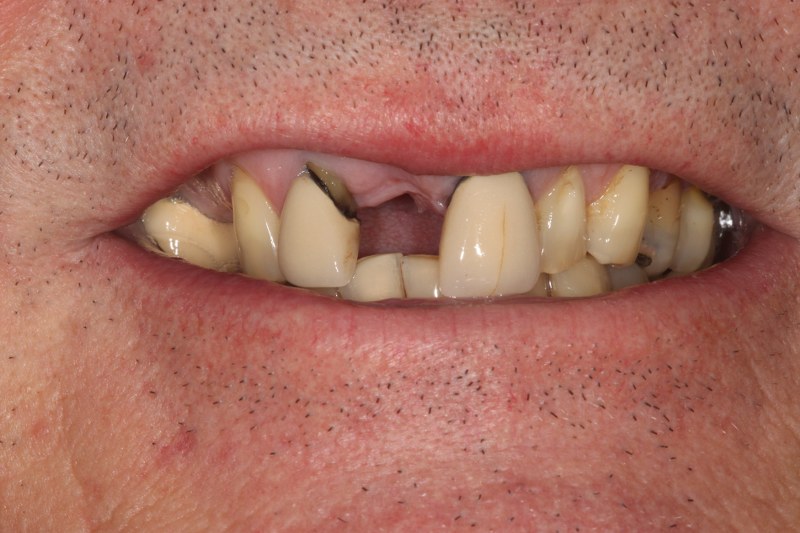 Before - Cheadle Hulme Dental