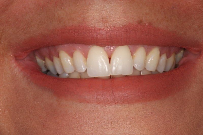 Before - Cheadle Hulme Dental