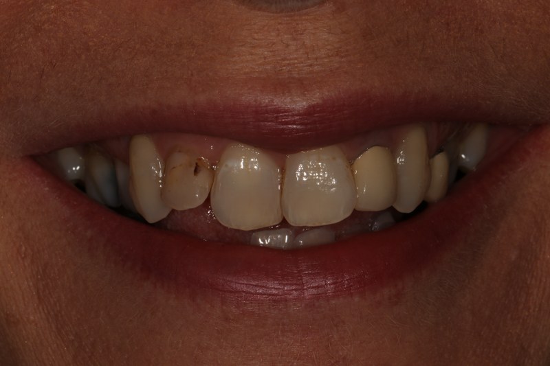 Before - Cheadle Hulme Dental