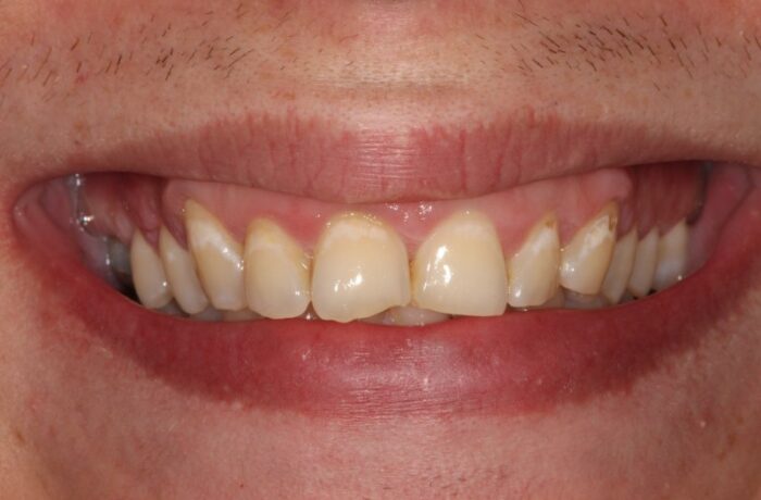 Before - Cheadle Hulme Dental