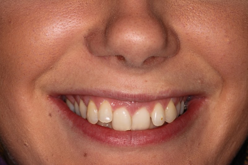 Before - Cheadle Hulme Dental