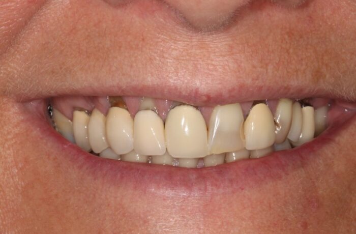 Before - Cheadle Hulme Dental