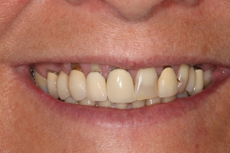 Before - Cheadle Hulme Dental